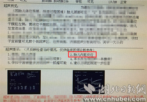 QQ图片20170410143607_副本.png