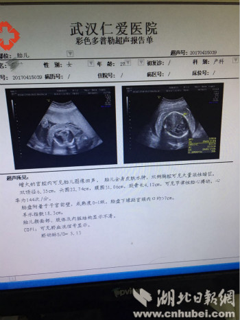 图片 1_meitu_1.jpg